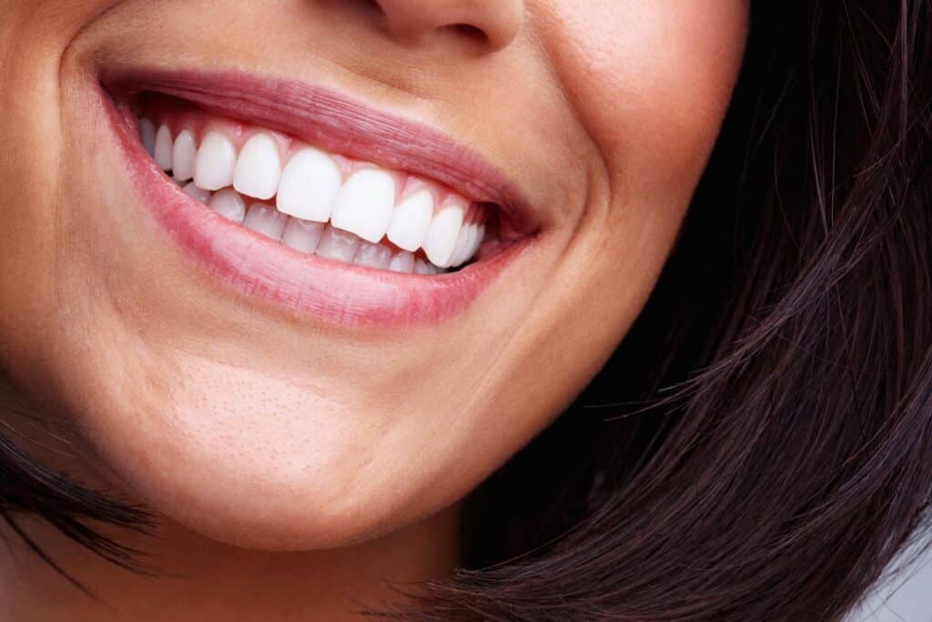 Close up of a woman smiling and showing off her shiny, white veneers